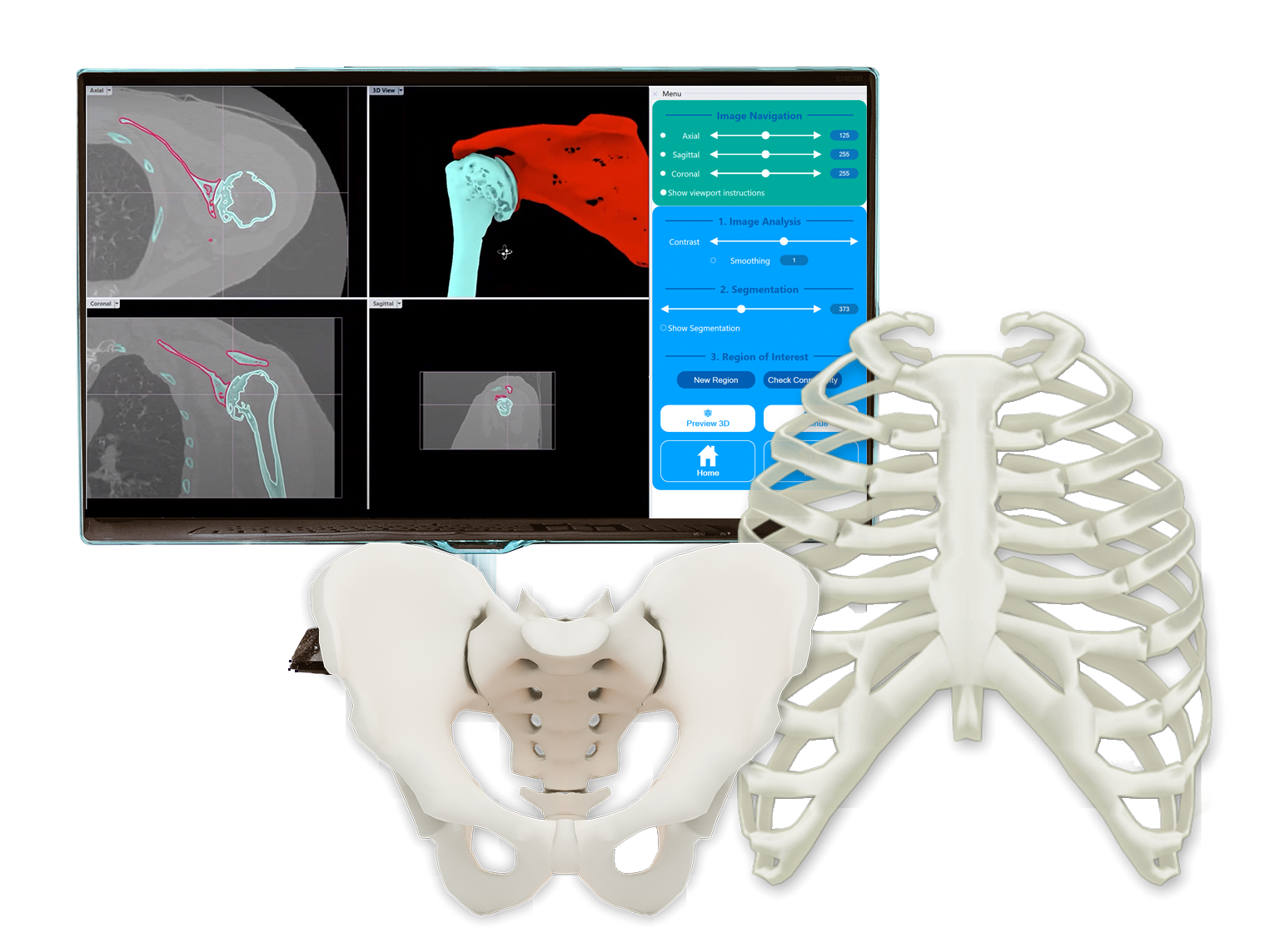 Rhino 3D Medical-